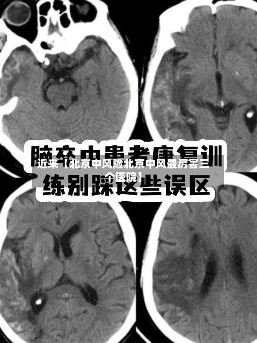 近来【北京中风险北京中风最厉害三个医院】
